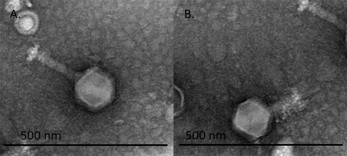 Two transmission electron micrographs of a jumbo phage with a large hexagonal head and a tail, next to 500-nanometre scale bars
