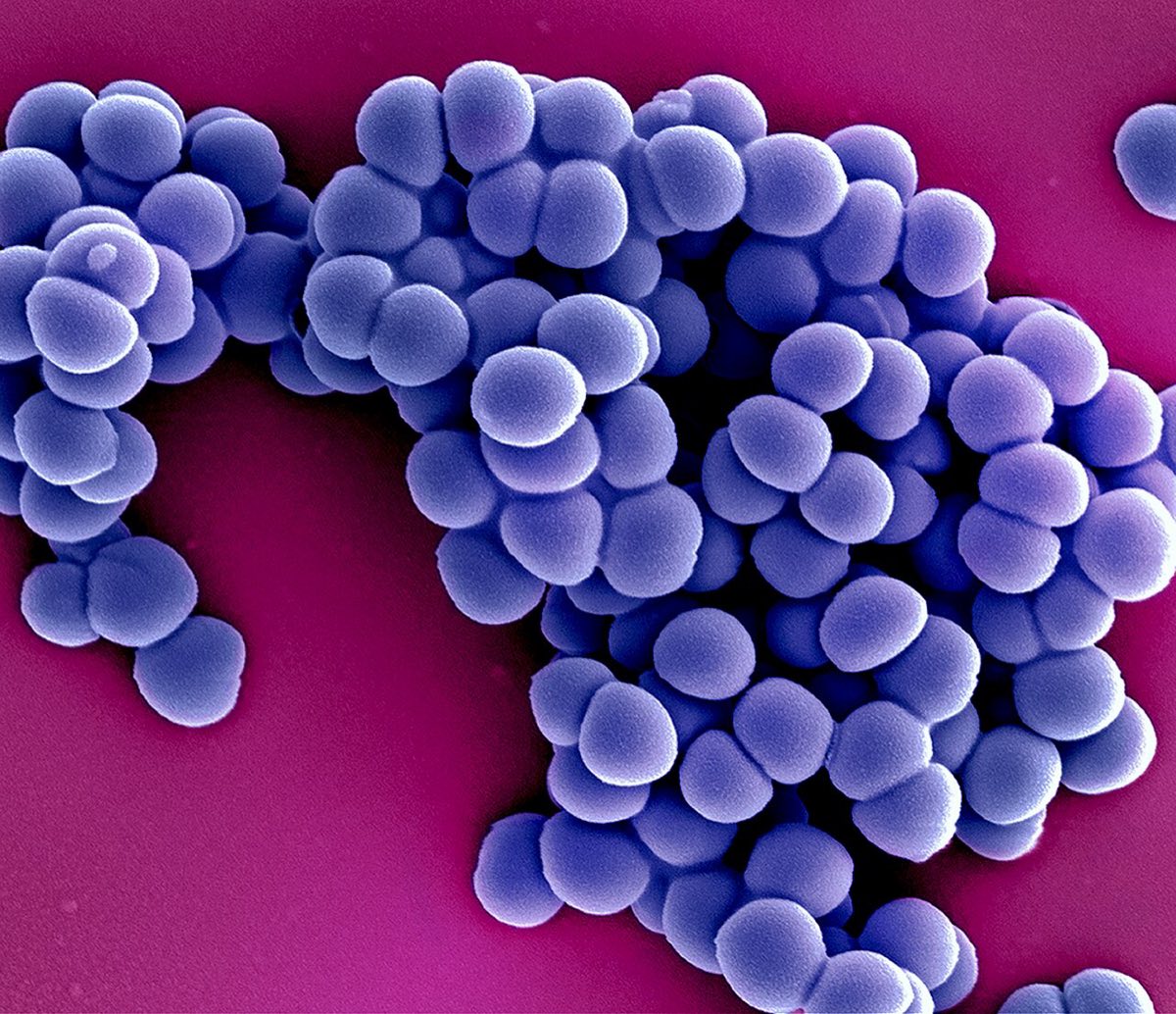 Colourised scanning electron micrograph of clustered round purple bacteria
